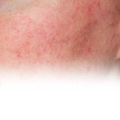 Stressed Skin